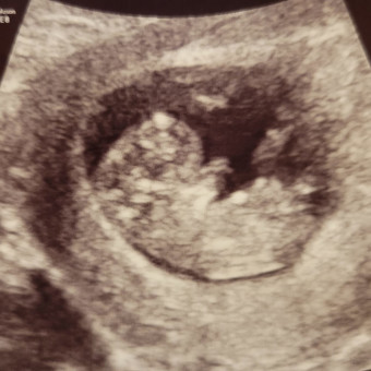Babylist Registry Photo.