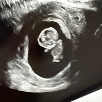 Babylist Registry Photo.