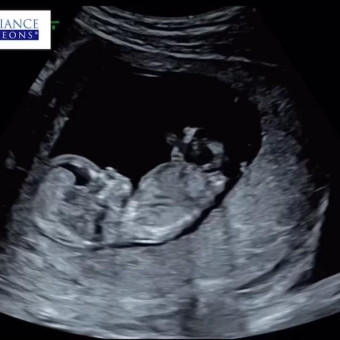 Babylist Registry Photo.