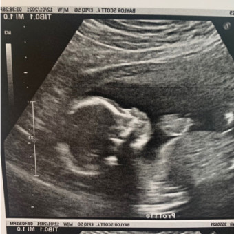 Babylist Registry Photo.