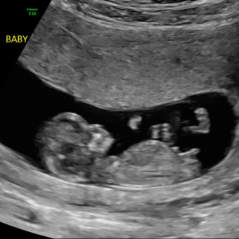 Babylist Registry Photo.