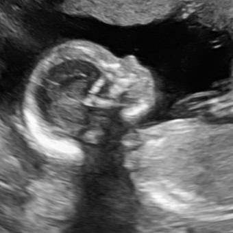 Babylist Registry Photo.