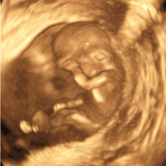 Babylist Registry Photo.