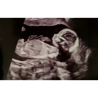 Babylist Registry Photo.