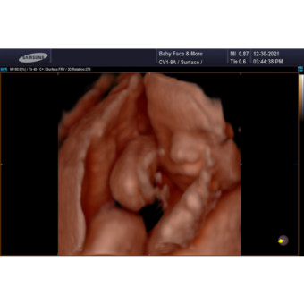 Babylist Registry Photo.