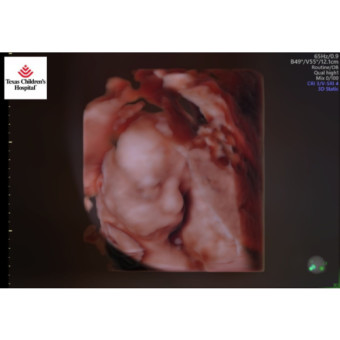 Babylist Registry Photo.