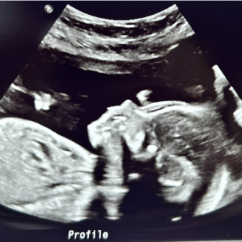 Babylist Registry Photo.
