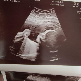 Babylist Registry Photo.