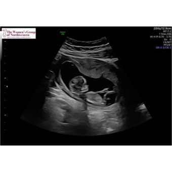 Babylist Registry Photo.