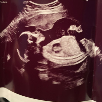 Babylist Registry Photo.