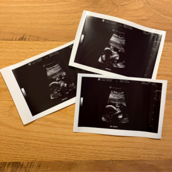 Babylist Registry Photo.