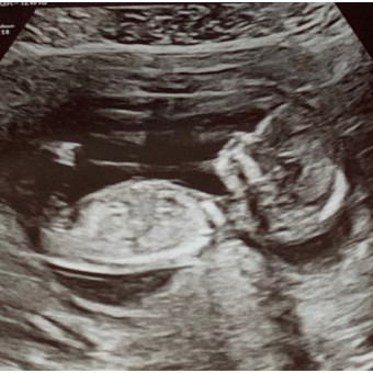 Babylist Registry Photo.