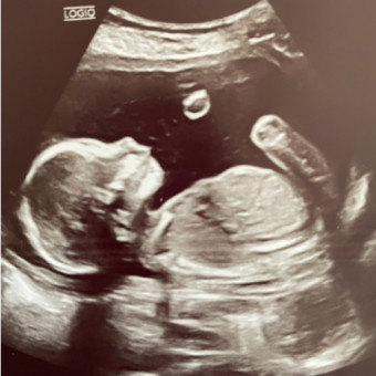 Babylist Registry Photo.