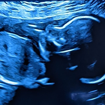 Babylist Registry Photo.