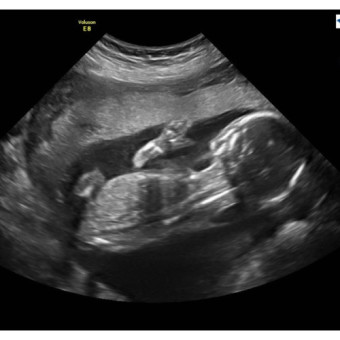 Babylist Registry Photo.