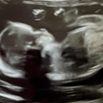 Babylist Registry Photo.