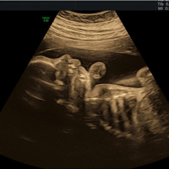 Babylist Registry Photo.