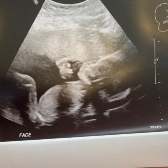 Babylist Registry Photo.