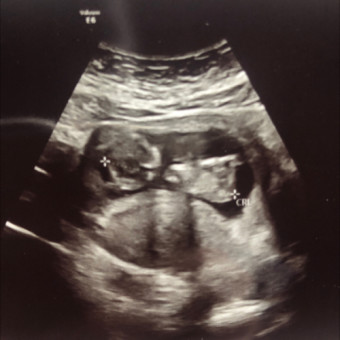 Babylist Registry Photo.
