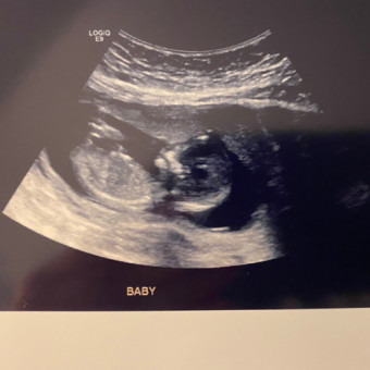 Babylist Registry Photo.