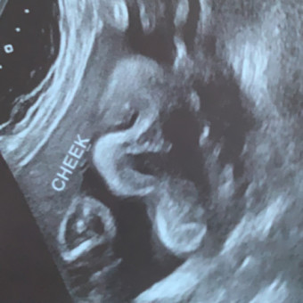 Babylist Registry Photo.