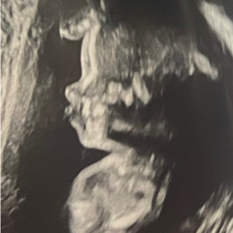 Babylist Registry Photo.