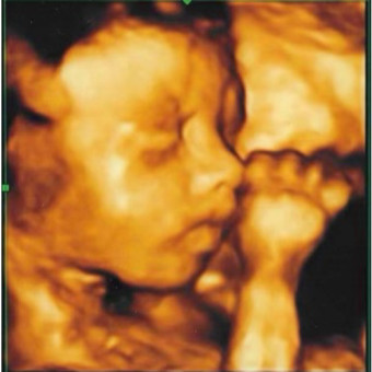 Babylist Registry Photo.