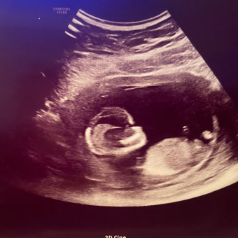 Babylist Registry Photo.