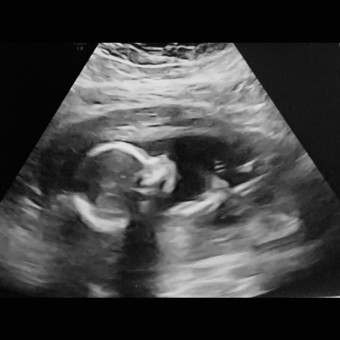 Babylist Registry Photo.