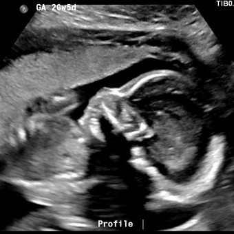 Babylist Registry Photo.