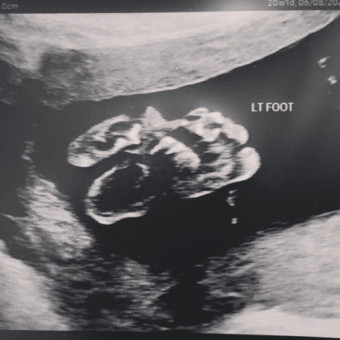 Babylist Registry Photo.