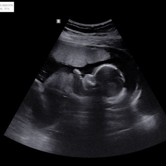 Babylist Registry Photo.