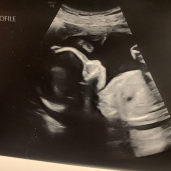 Babylist Registry Photo.