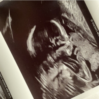 Babylist Registry Photo.
