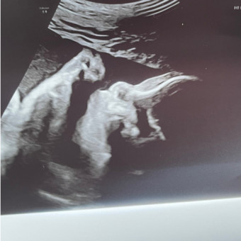 Babylist Registry Photo.
