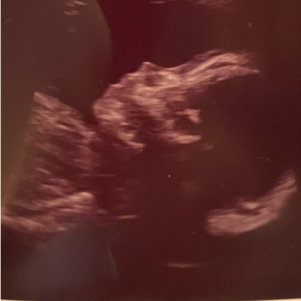 Babylist Registry Photo.