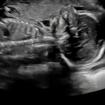 Babylist Registry Photo.