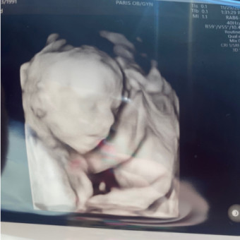 Babylist Registry Photo.