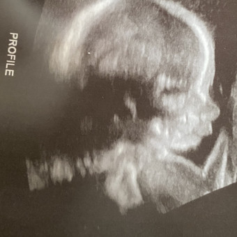 Babylist Registry Photo.