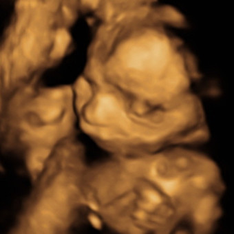 Babylist Registry Photo.
