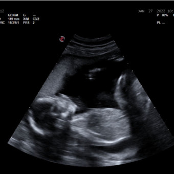 Babylist Registry Photo.