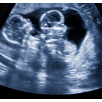 Babylist Registry Photo.