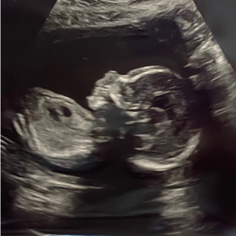Babylist Registry Photo.
