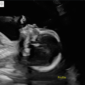Babylist Registry Photo.