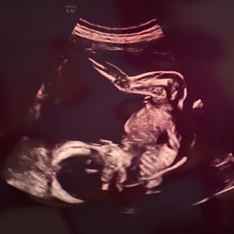 Babylist Registry Photo.