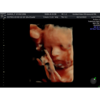 Babylist Registry Photo.