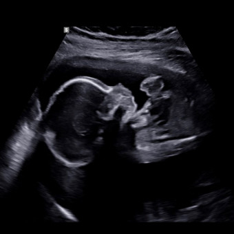 Babylist Registry Photo.