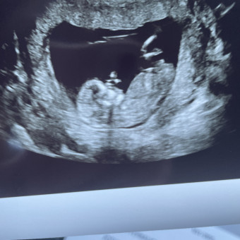 Babylist Registry Photo.