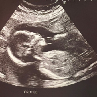 Babylist Registry Photo.