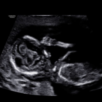 Babylist Registry Photo.